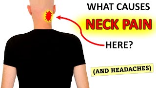 What Causes Upper Neck Pain And Headaches [upl. by Stone]