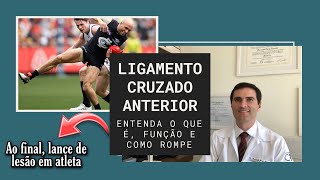 LIGAMENTO CRUZADO ANTERIOR Entenda tudo sobre o que Ã© para que serve e como rompe [upl. by Osana]