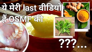 ये मेरी last vedio है OSMF की। submucous Fibrosis Treatment।osmf को कैसे पहचाने। कैसे ठीक करें [upl. by Rhines]