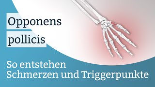 Opponens pollicis Schmerzen Triggerpunkte und deren Aktivierung [upl. by Lawson]