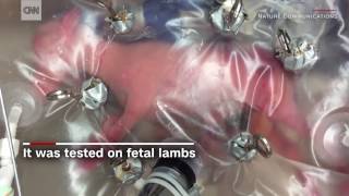 Scientists create artificial womb [upl. by Tteirrah]