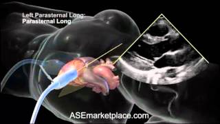 How to do a Basic Transthoracic Echocardiogram Transducer Position and Anatomy [upl. by Callan]