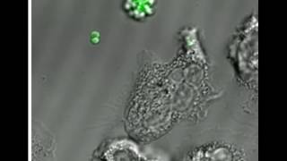 Phagocytosis of MRSA by a human neutrophil [upl. by Ettenig]