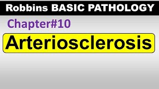 Ch10  Arteriosclerosis  Blood Vessel Pathology  Robbins Lectures [upl. by Wilonah]