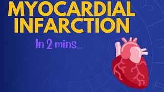 Myocardial Infarction in 2 mins [upl. by Alexandrina]