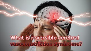 Health information WHAT Í REVERSIBLE CEREBRAL VASOCONSTRICTIONS SYNDROME [upl. by Theresita950]