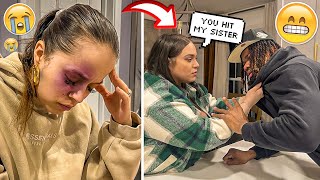 Shane Gave Me A Bruise AND MY SISTER LOST IT Prank Gone Extremely Wrong [upl. by Darreg457]