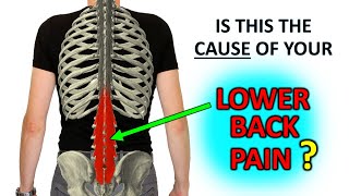 Recurrent Lower Back Pain The Research Says… Do This [upl. by Brotherson]