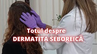 Totul despre dermatita seboreica  DermaBeauty Clinique [upl. by Nylevol991]