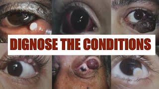 PATHOLOGICAL EYE CONDITIONS 1 Ophthalmology Osce [upl. by Aseyt32]