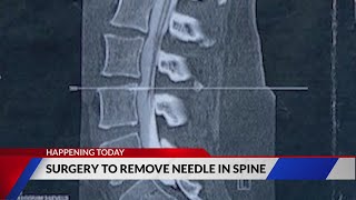 Illinois woman having surgery to remove needle in spine today [upl. by Nalid580]