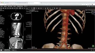 Edit DICOM Medical Images With Purview Image™ [upl. by Rafaelof]