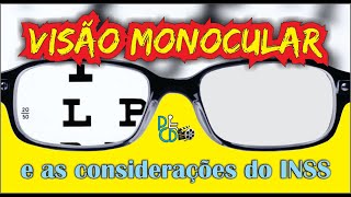 Visão monocular considerações do INSS sobre o assunto [upl. by Nace72]