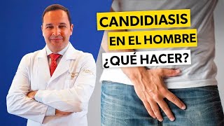 Cómo librarse de la CANDIDIASIS MASCULINA rápidamente [upl. by Pierre]