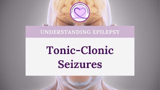 What are TonicClonic Seizures [upl. by Aysan158]