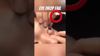 Eye Drop Fail viralvideo memes shorts funny mrbean yoitubeshorts [upl. by Proctor]