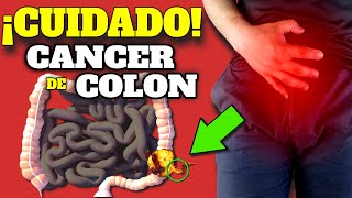 ¡TENE CUIDADO Estos SINTOMAS de ALARMA pueden ser CANCER de COLON CANCER de COLON PREVENCION [upl. by Letha]