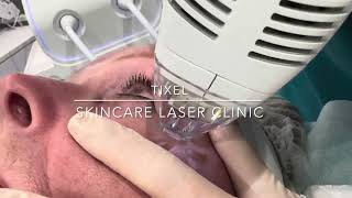 TIXEL  SKINCARE LASER CLINIC  POINTCOOK  MELBOURNE [upl. by Rumit]