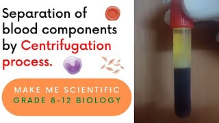 Separation of Human Blood Components by Centrifugation Process  Grade 812  Biology Demo [upl. by Aidas]