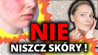 NA RATUNEK BHL  reakcja na retinol  wypryski  sucha  podrażniona skóra  peptyd miedziowy Bandi [upl. by Tiloine561]