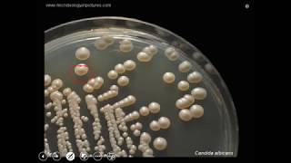 Candida albicans culture pathogenesis and laboratory diagnosis [upl. by Eugenides]