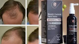 NT HAIRFALL PRO 116 REMEDIES Topical Solution Minoxidil amp Finasteride Topical Solution [upl. by Mcdougall154]