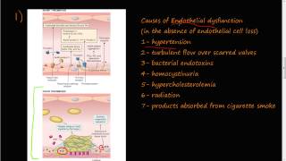 53  Thrombosis Virchows triad Endothelial Injury [upl. by Merritt506]