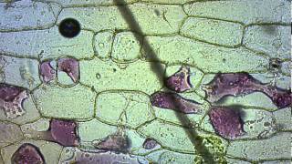 Red Onion Plasmolysis and Cytolysis [upl. by Lawford951]