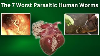 The 7 Worst Parasitic Worms  BEWARE [upl. by Hilleary]