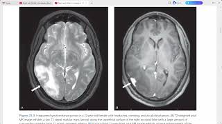 RADIOLOGY EXAM CASES [upl. by Rai]