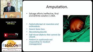 011 IOACON 2018 CME Dr SKS Marya [upl. by Kippie138]