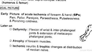 volkman ischemic contracture [upl. by Idna]