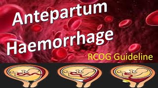 Preeclampsia Eclampsia in Pregnancy Nursing Review Pathophysiology Symptoms NCLEX [upl. by Attayek]