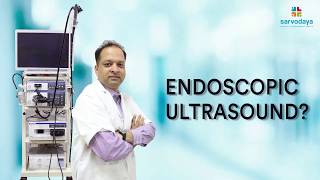 What is Endoscopic Ultrasound [upl. by Walter]