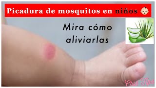 Como aliviar las picaduras de mosquitos en niños [upl. by Imugem934]