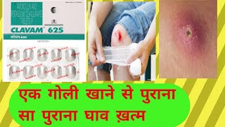 Clavam 625 Tablet Uses in Hindi  Clavam 625 mg  Clavam 625 Side effects in hindi [upl. by Judenberg]