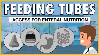 Types of Feeding Tubes EXPLAINED [upl. by Lasiaf360]