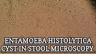 Entamoeba Histolytica Cyst under stool microscopy MLT WORLD [upl. by Johnsson]