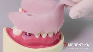 Mastering Precision Closed Impression Technique with MEDENTiKA® Microcone Implant 🌐🦷 [upl. by Fonseca]