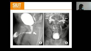 Urological investigation 03 Cystogram Urethrogram Antrograde Transrectal Ultrasound [upl. by Lenard]