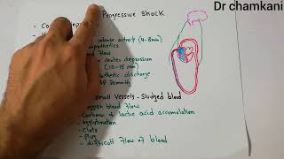 CVS 244  Progressive shock part 2  Vasomotor failure  Blockage of small vessels sludged blood [upl. by Obaza687]