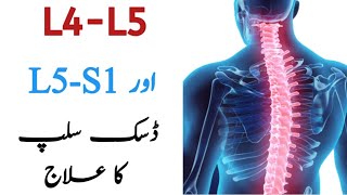 L4L5 L5S1 Disc Slip Treatment  Chiropractic Treatment in Pakistan [upl. by Sirama762]