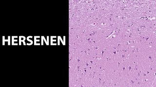 Hersenen histologiemicroscopie van de hersenen [upl. by Therine]