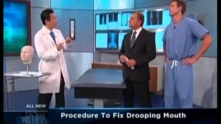 The Doctors  Dr Youn Presents The Grin Lift Corner Mouth Lift [upl. by Uot]