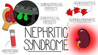 Understanding Nephritic Syndrome With Pathology Made Easy [upl. by Eehc]