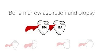 Bone Marrow Biopsy amp Aspiration BMBx [upl. by Attenyl]