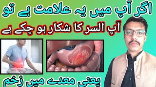 ulcer symptoms in urdu UlserTreatment [upl. by Millard669]