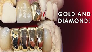 How to create a Gold and Diamond Restoration [upl. by Manbahs361]