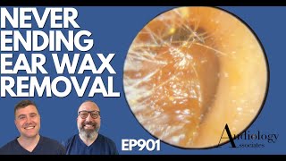 NEVERENDING EAR WAX REMOVAL  EP901 [upl. by Nemlaz]