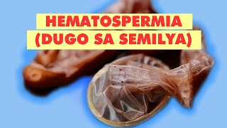 QampA HEMATOSPERMIA O DUGO SA SEMILYA  FAQ [upl. by Arihaz]